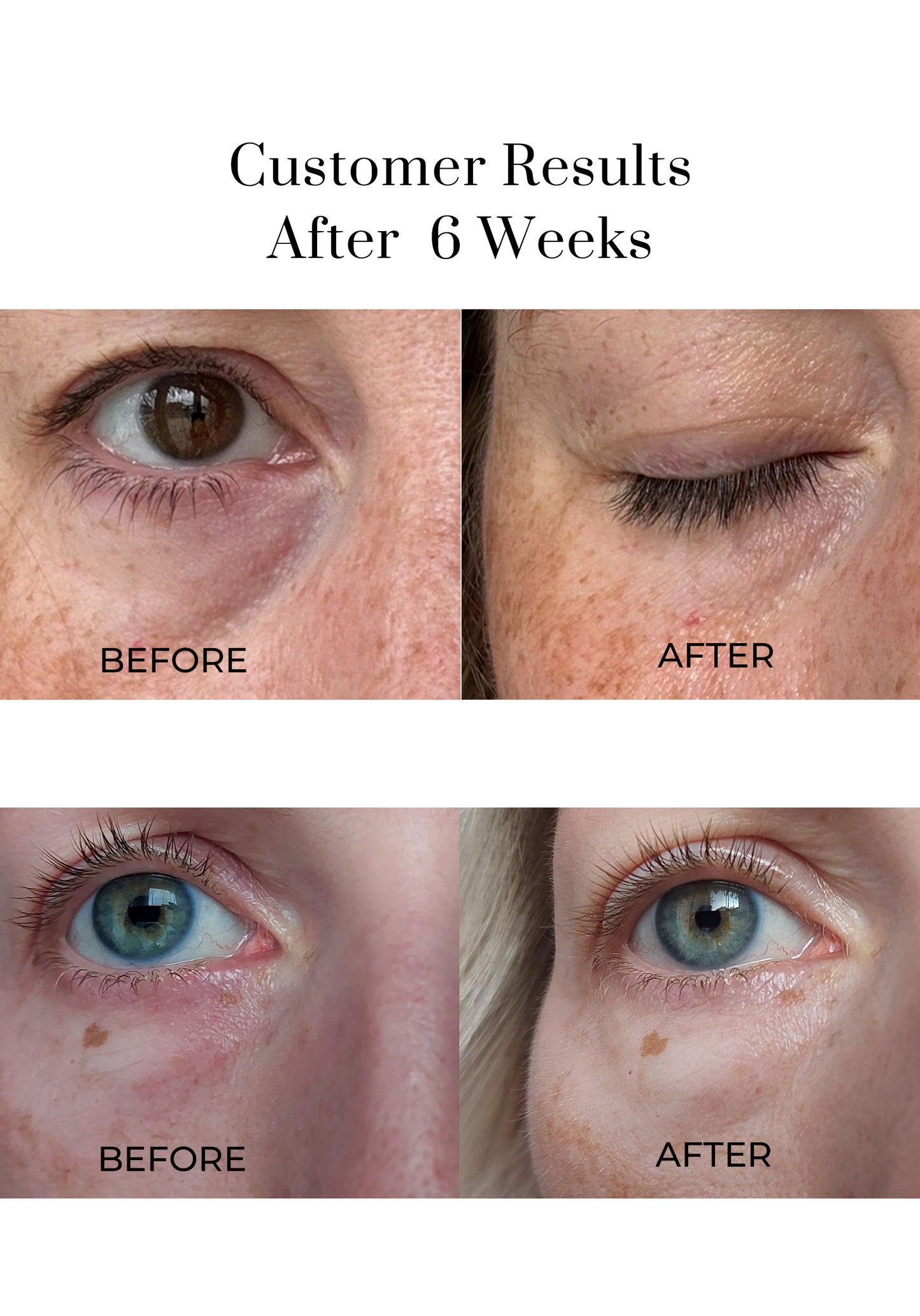 Customer Results of our Eye Wonder Nutri-Active Eye Serum