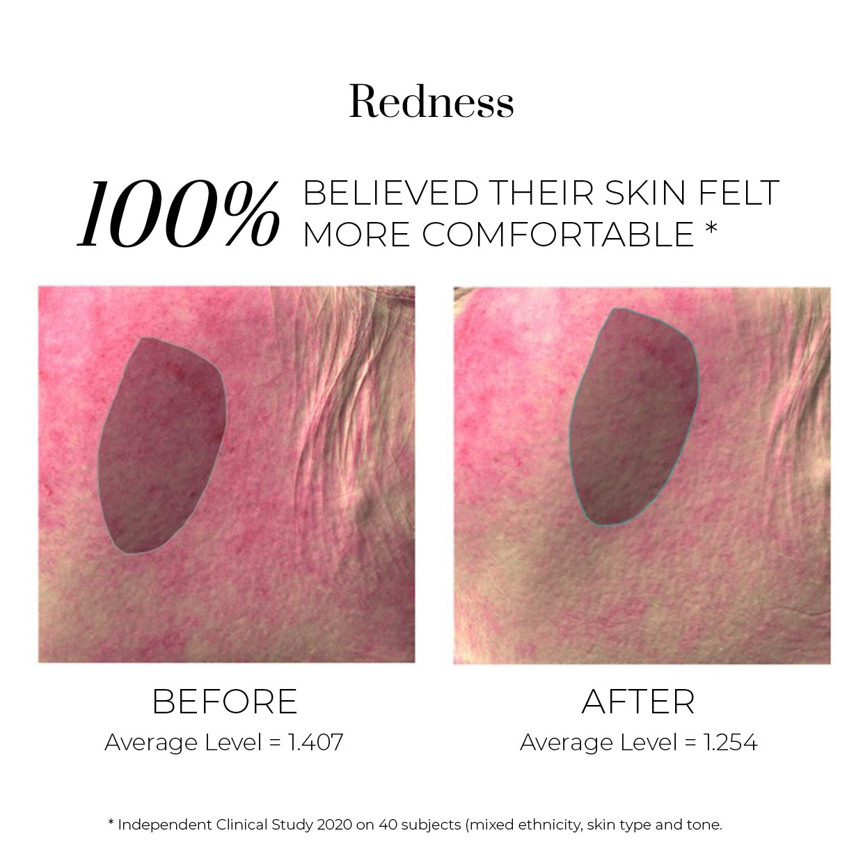 Isotonisches Hydra-Serum